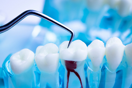 <br title='b11'>a rendering of a tooth with the root indicatedGrins & Giggles Family Dentistry in Spokane Valley, WA<br title='b11'> <br title='b11'>a rendering of a tooth with the root indicatedGrins & Giggles Family Dentistry in Spokane Valley, WA<br title='b11'>