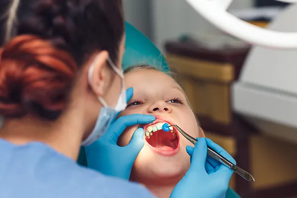 Young boy patiently keeping his mouth open while his female dental assistant applies fluoride at Grins & Giggles Family Dentistry in Spokane Valley, WA Young boy patiently keeping his mouth open while his female dental assistant applies fluoride at Grins & Giggles Family Dentistry in Spokane Valley, WA